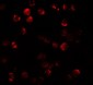 DNM1L / DRP1 Antibody (Internal)